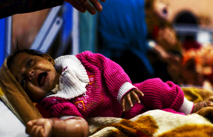 Anak-anak Menangis Kelaparan Terpaksa Mereka Di Bius Supaya Tertidur